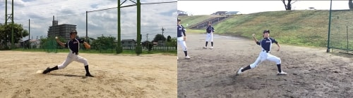 投球フォームについては当院にお任せください。