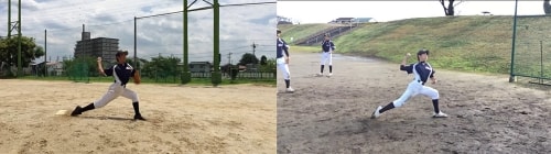 野球肘は地域NO,1の当院へ