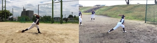 野球の障害を改善させます。